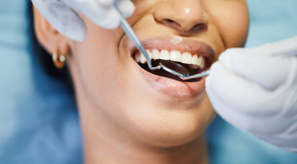 Best Emergency Dental Care for Broken or Chipped Teeth in Elk Point, SD